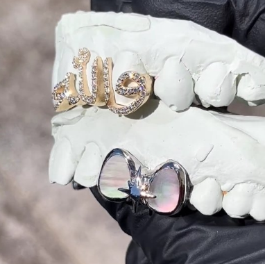 Custom Gold Teeth